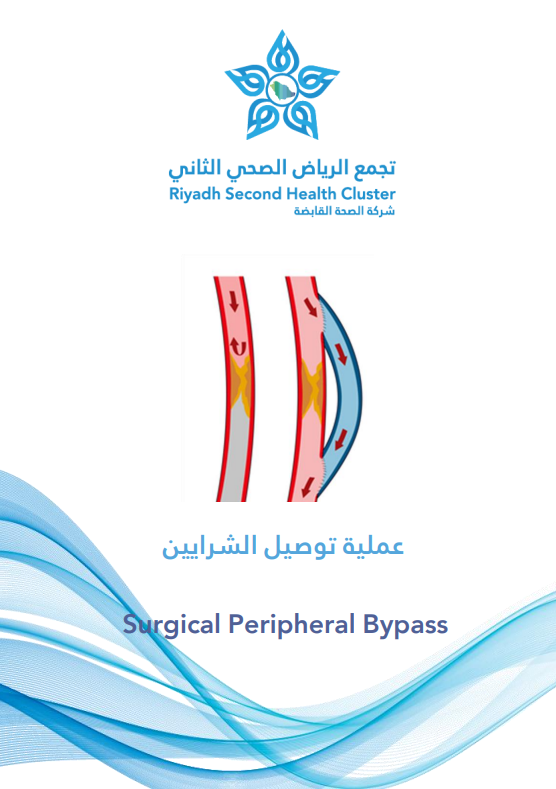 HEM1.24.0001687 Surgical Peripheral Bypass.pdf